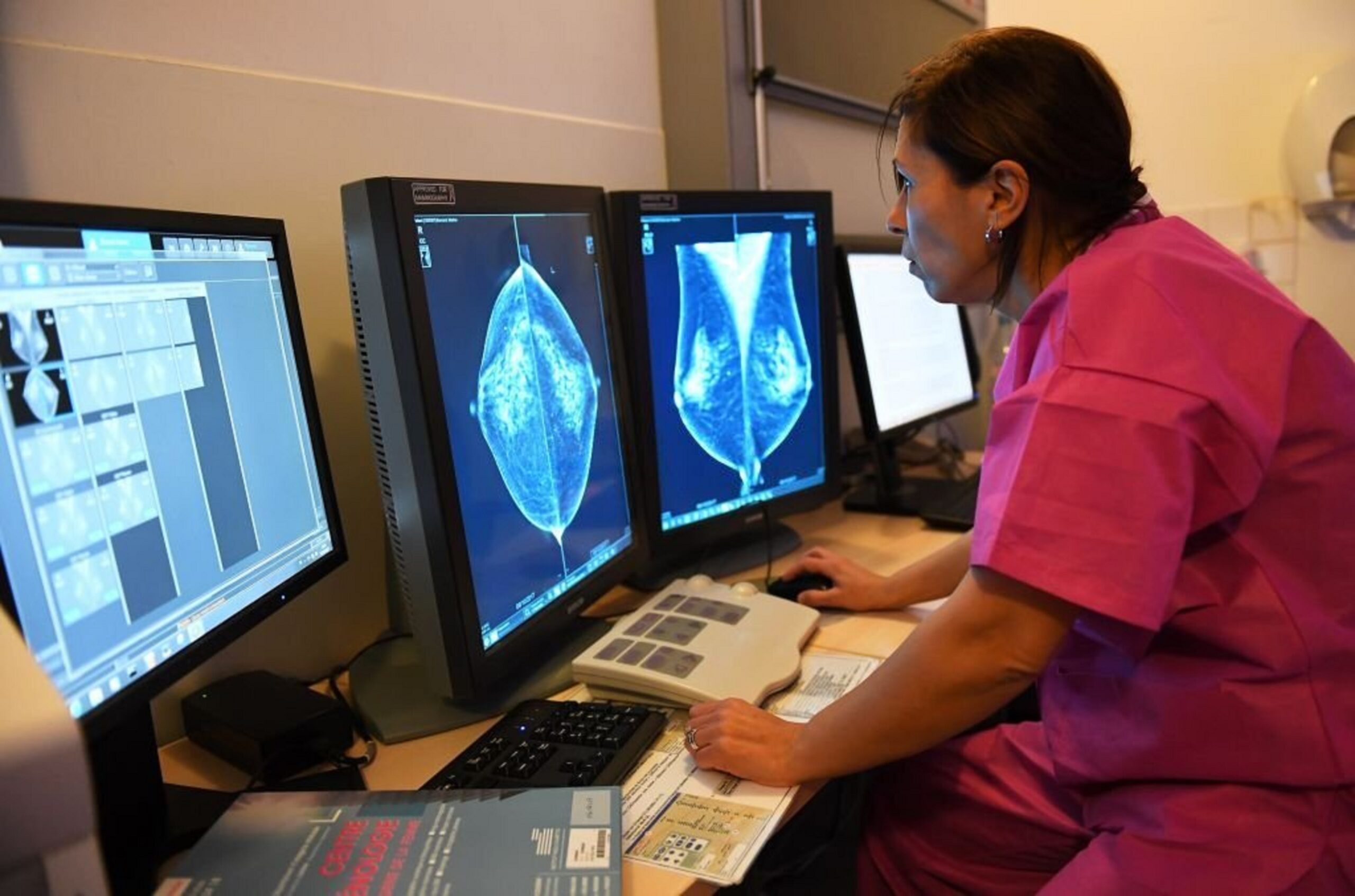 IA na Radiologia: Transformando Diagnósticos Médicos