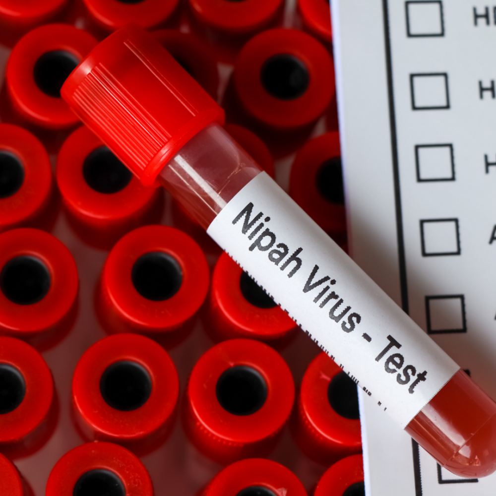 Vírus Nipah (NiV)