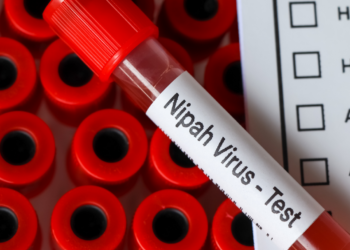 Vírus Nipah (NiV)